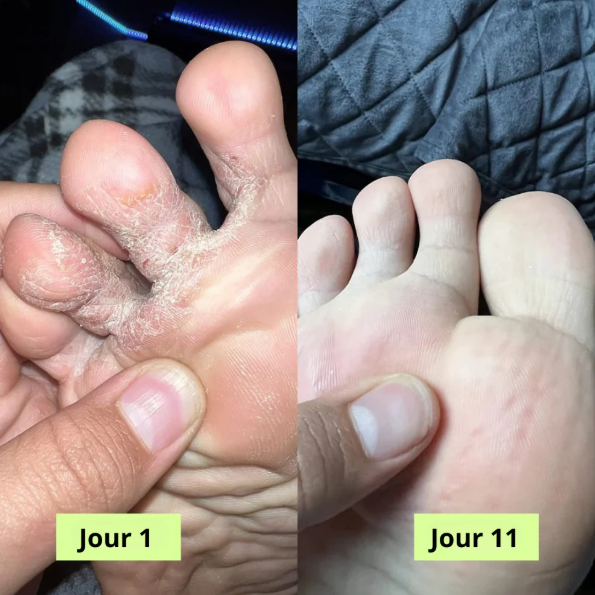 Nola® Savon Purifiant Antifongique