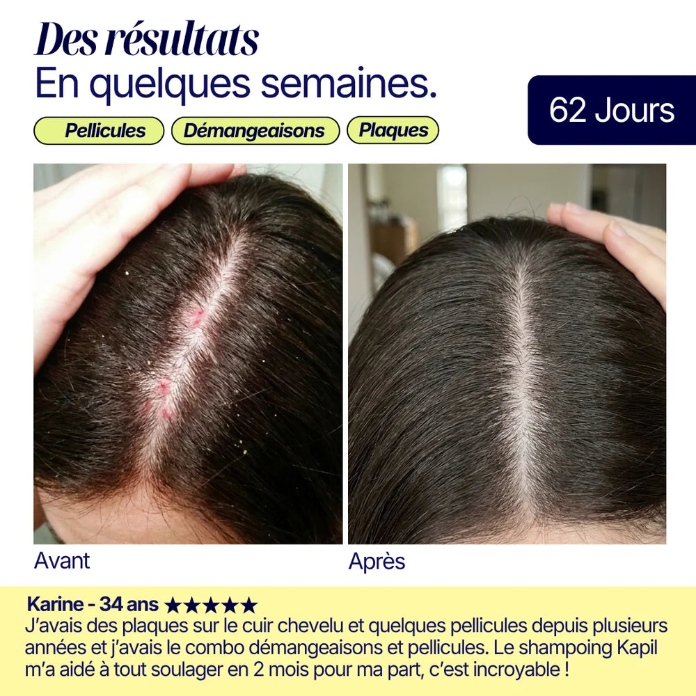 Shampoing solide anti-pelliculaire · apaisant & doux