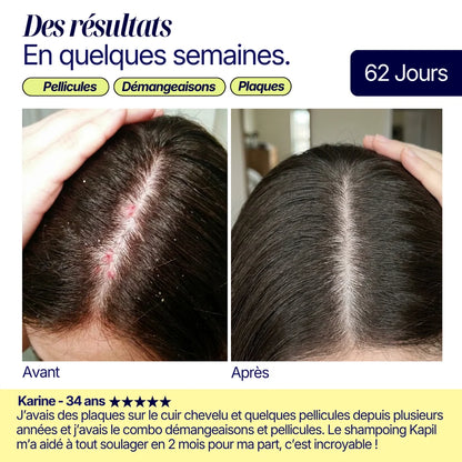 Shampoing solide anti-pelliculaire · apaisant & doux