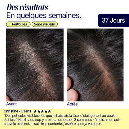 Shampoing solide anti-pelliculaire · apaisant & doux