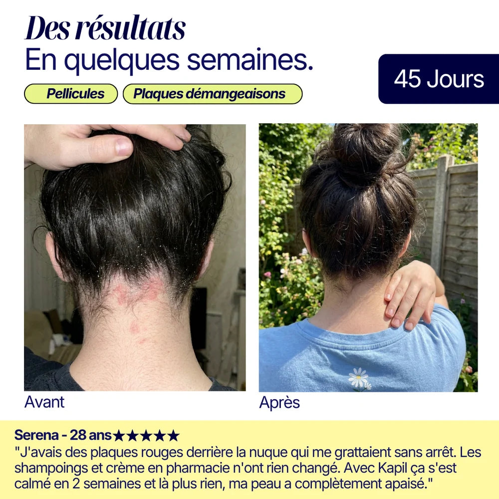 Shampoing solide anti-pelliculaire · apaisant & doux