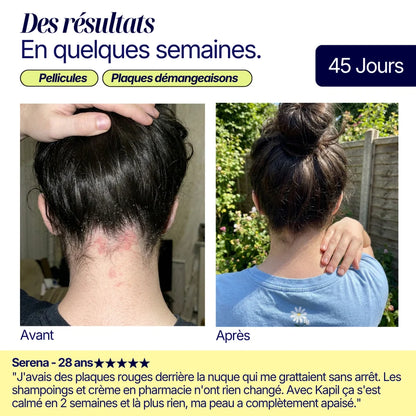 Shampoing solide anti-pelliculaire · apaisant & doux