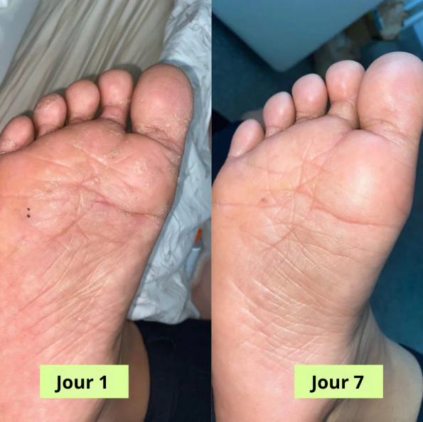 Nola® Savon Purifiant Antifongique