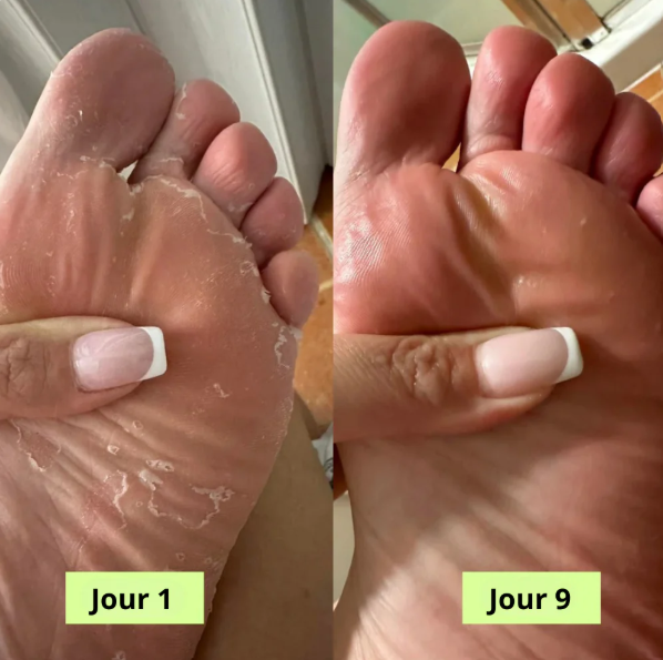 Nola® Savon Purifiant Antifongique