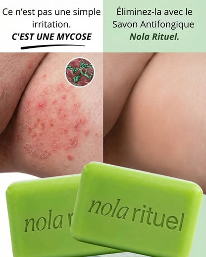 Nola® Savon Purifiant Antifongique